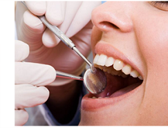 dental bonding NYC